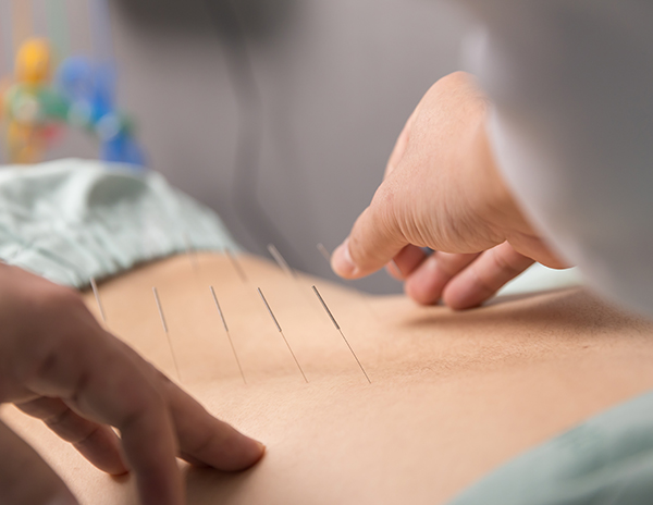 약침치료 이미지