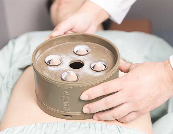 부항 · 뜸치료 이미지