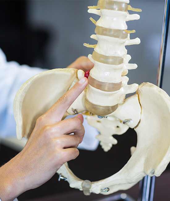 골반 불균형 · 틀어짐