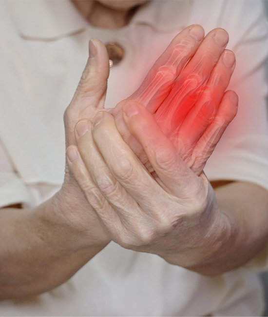 손 · 손가락 건초염