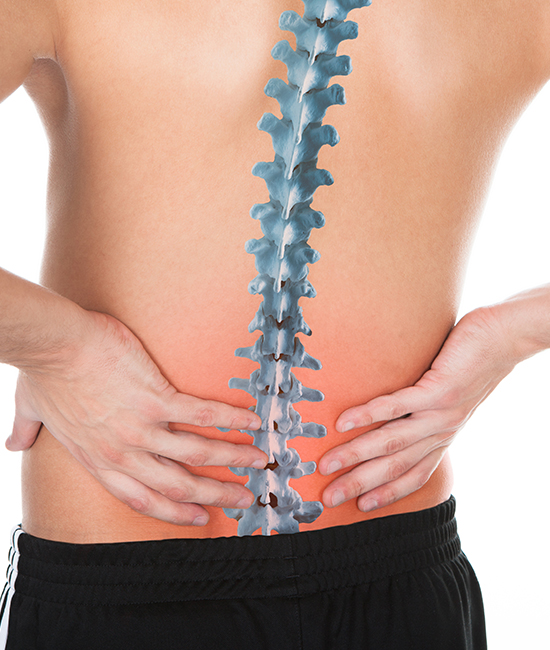 척추측만 · 척추 비틀림