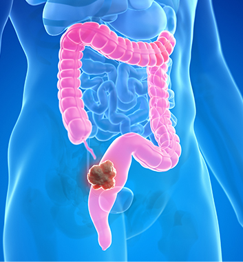 부작용 · 통증 관리